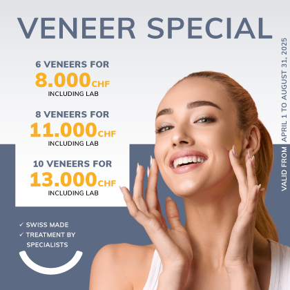 Zahnarzt Zürich Löwenplatz Veneers Aktion 