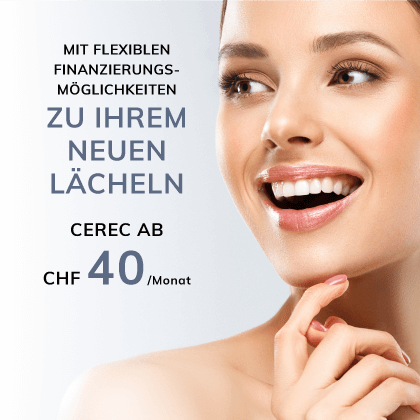 Zahnarzt Zürich Löwenplatz CEREC Aktion 